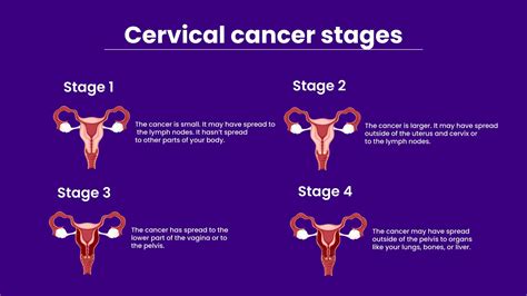 How Common Is Cervical Cancer