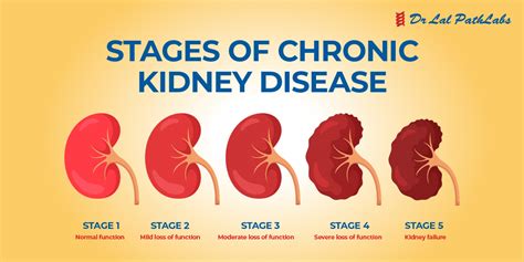 How Common Is Kidney Disease