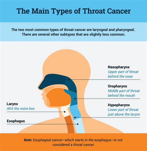 How Common Is Throat Cancer