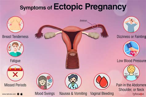 How Dangerous Is Ectopic Pregnancy