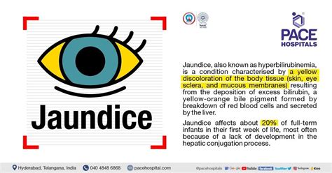 How Dangerous Is Jaundice
