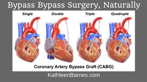 How Dangerous Is Quadruple Bypass Surgery