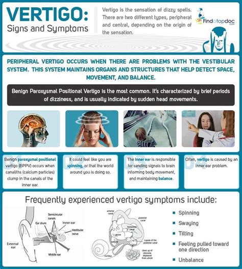 How Dangerous Is Vertigo