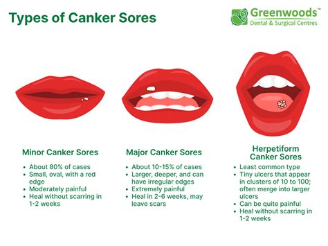 How Do Canker Sores Form