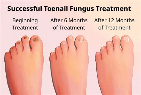 How Do Toenails Grow