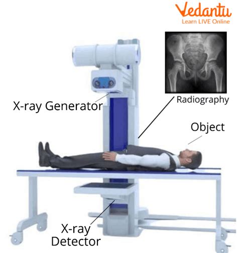 How Does It Work X Ray
