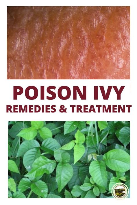 How Does Poison Ivy Spread