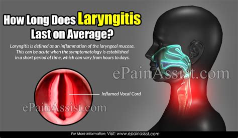 How Long Do Laryngitis Last