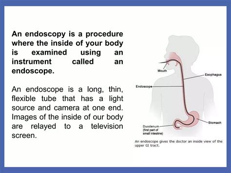 How Long Is An Endoscopy