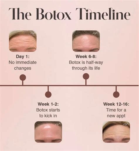 How Long Until Botox Kicks In