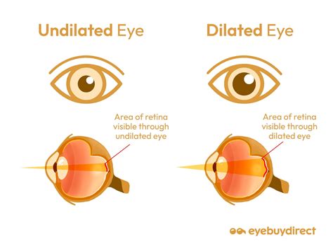 How Long Until Eye Dilation Wears Off