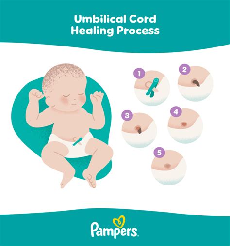 How Long Until Umbilical Cord Turns White