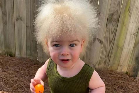 How Rare Is White Hair