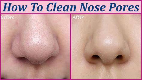 How To Clean Nose Pores