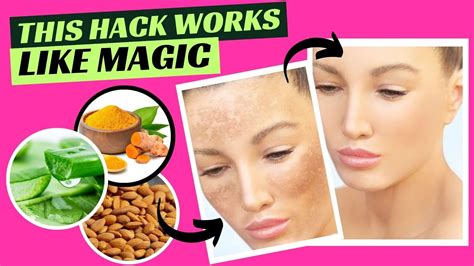 How To Eliminate Hyperpigmentation