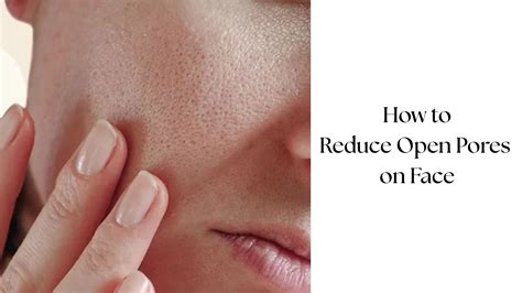 How To Permanently Reduce Pores