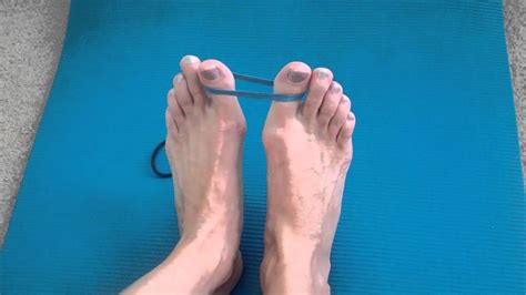 How To Prevent Bunions