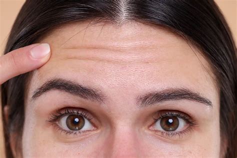 How To Prevent Forehead Wrinkles