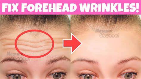 How To Reduce Forehead Wrinkles