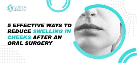 How To Reduce Swelling On Face After Surgery