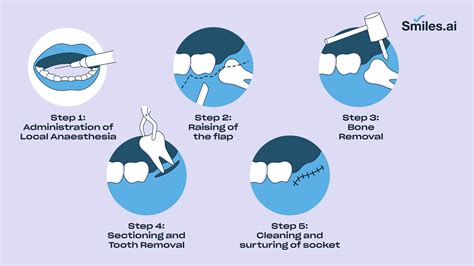 How To Remove A Tooth
