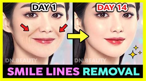 How To Remove Smile Lines