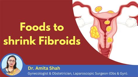 How To Shrink Fibroids