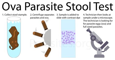 How To Test For Parasites