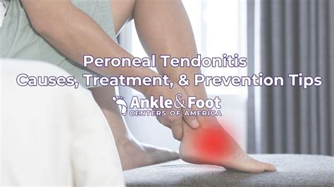 How To Treat Tendonitis