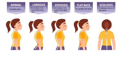 Hump Back Of Neck