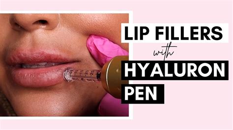 Hyaluron Pen Lip Filler