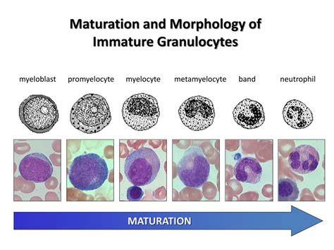 Immature Granulocytes 0
