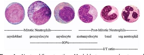 Immature Granulocytes High