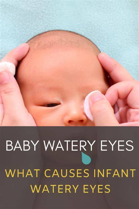 Infant Eyes Watery