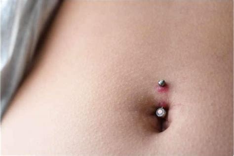Infected Belly Button Piercing