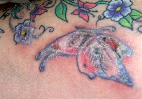 Infected Tattoo Signs Symptoms