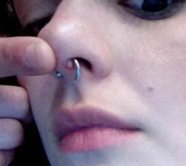 Infection Septum Piercing