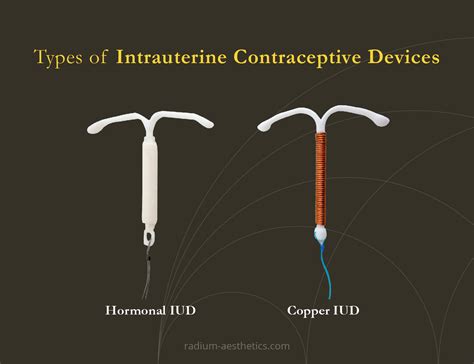 Intrauterine Device Picture