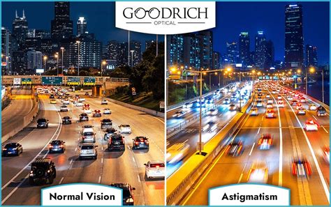 Is Astigmatism Curable