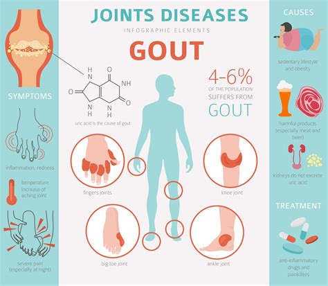 Is Gout Hereditary