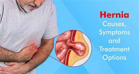 Is It Dangerous To Ignore A Hernia