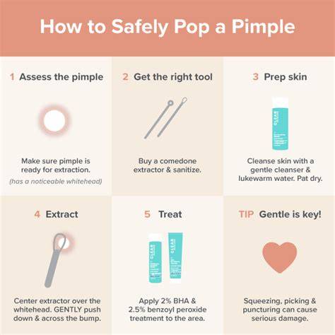 Is It Okay To Pop Pimples