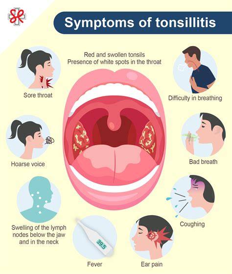 Is To Tonsillitis Contagious