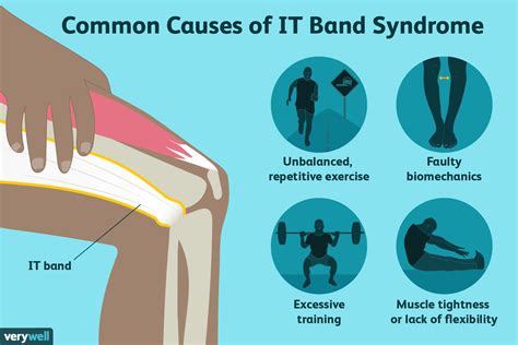 It Band Syndrome Symptoms