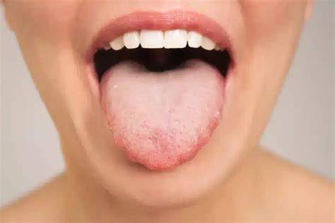 Itch On Tongue