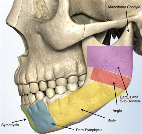 Jaw Bone Fracture Symptoms