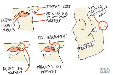 Jaw Clicking On One Side