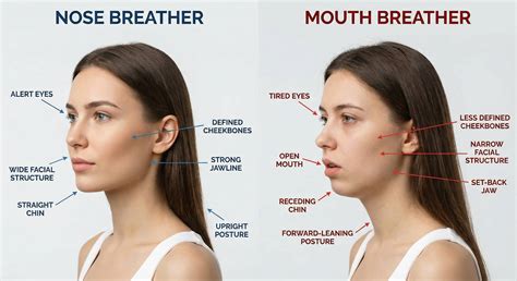 Jawline Mouth Breathing