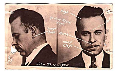 John Dillinger Face Surgery