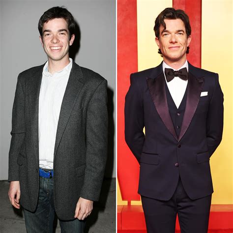 John Mulaney Face Surgery